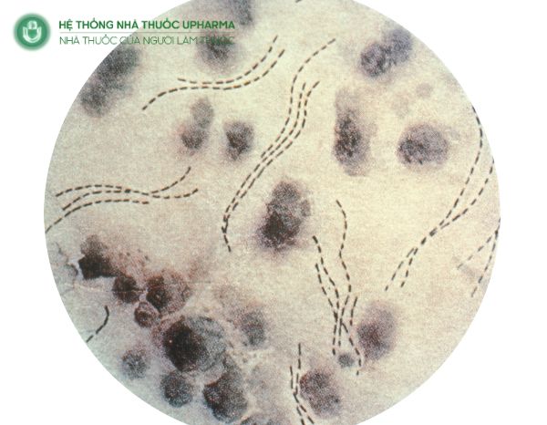 Hib thuộc loại vi khuẩn Gram âm thuộc họ Pasteurellaceae